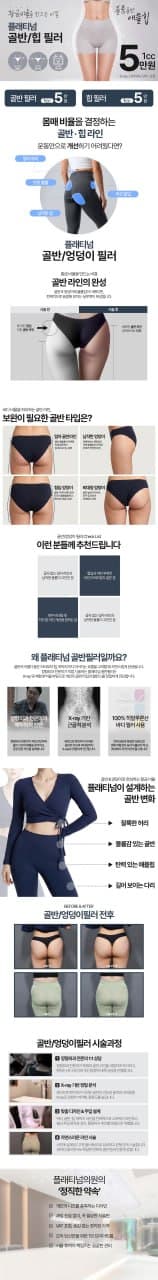 골반 필러 386cc 시술 전